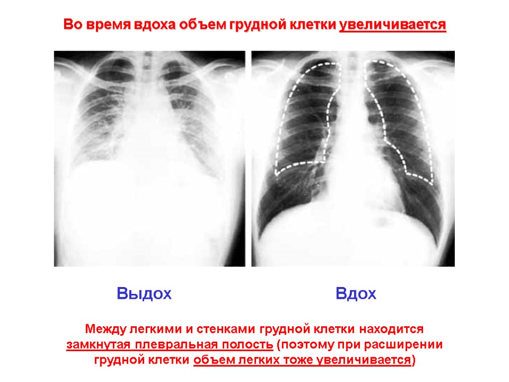 Во время вдоха объем грудной клетки увеличивается Выдох Вдох Между легкими и стенками грудной